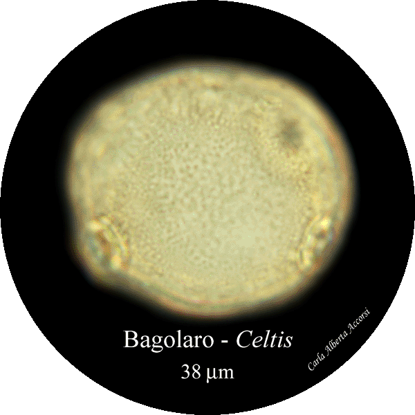 Celtis-bagolaro-Hackberries-Polline-Pollen-Disco-polline-Pollenflora-MUSEOpalinologia-Foto-Carla-Alberta-Accorsi-600px